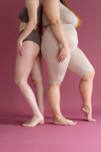Lipedema afecta principalmente