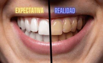 Salud oral versus filtros: la presión estética de las redes sociales Salud oral versus filtros: la presión estética de las redes sociales