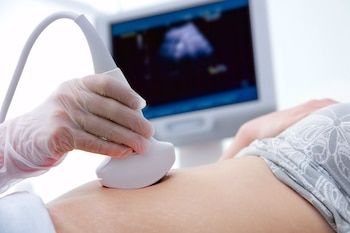 Cáncer de ovario, con