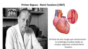 Se hizo el primer bypass