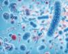 Los virus de las bacterias misteriosas pueden animar el daño causado por los antibióticos, según una investigación.