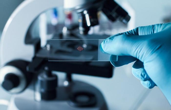 Noticias del día sobre laboratorios clínicos: un nuevo método basado en inteligencia artificial para el análisis de tejidos mejora la comprensión de la patología de la enfermedad – Patología –.