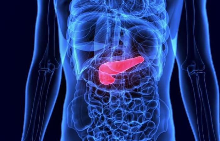 Cómo se detectan y tratan los tumores pancreáticos premalignos