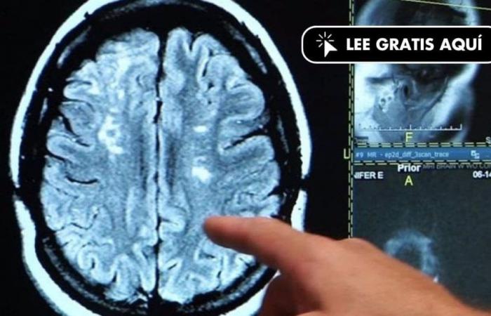 Una nueva técnica permite una visión inédita del cerebro en un tiempo récord