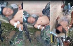 (Video) Ejército brindó asistencia médica a disidente que los atacó pero resultó herido – .