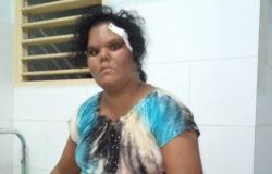 Denuncian golpiza a joven con discapacidad en Holguín – .
