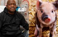 Murió el paciente que recibió el primer trasplante de un riñón de cerdo modificado genéticamente