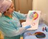 Hospital Dr. Gustavo Fricke entrega colorida impresión de placenta como recuerdo del parto – G5noticias – .