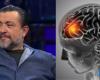 Qué es un derrame cerebral como el que le pasó a Leo Caprile y cómo reconocer los síntomas a tiempo
