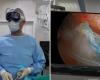Operan de lesión en el hombro con lentes Apple Vision Pro, este fue el resultado con realidad virtual