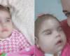 Niña en Pinar del Río despierta inconsciente después de 22 días