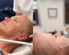 Mira el antes y el después de Xuxa tras someterse a 80 procedimientos dermatológicos a los 61 años