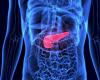 Cómo se detectan y tratan los tumores pancreáticos premalignos
